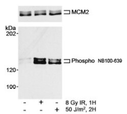 MCM2, p Ser108 Antibody, Novus Biologicals 0.1mg; Unlabeled:Antibodies,